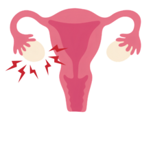 illustration of a uterus and ovaries with ouchy-like lightning bolts around a cyst